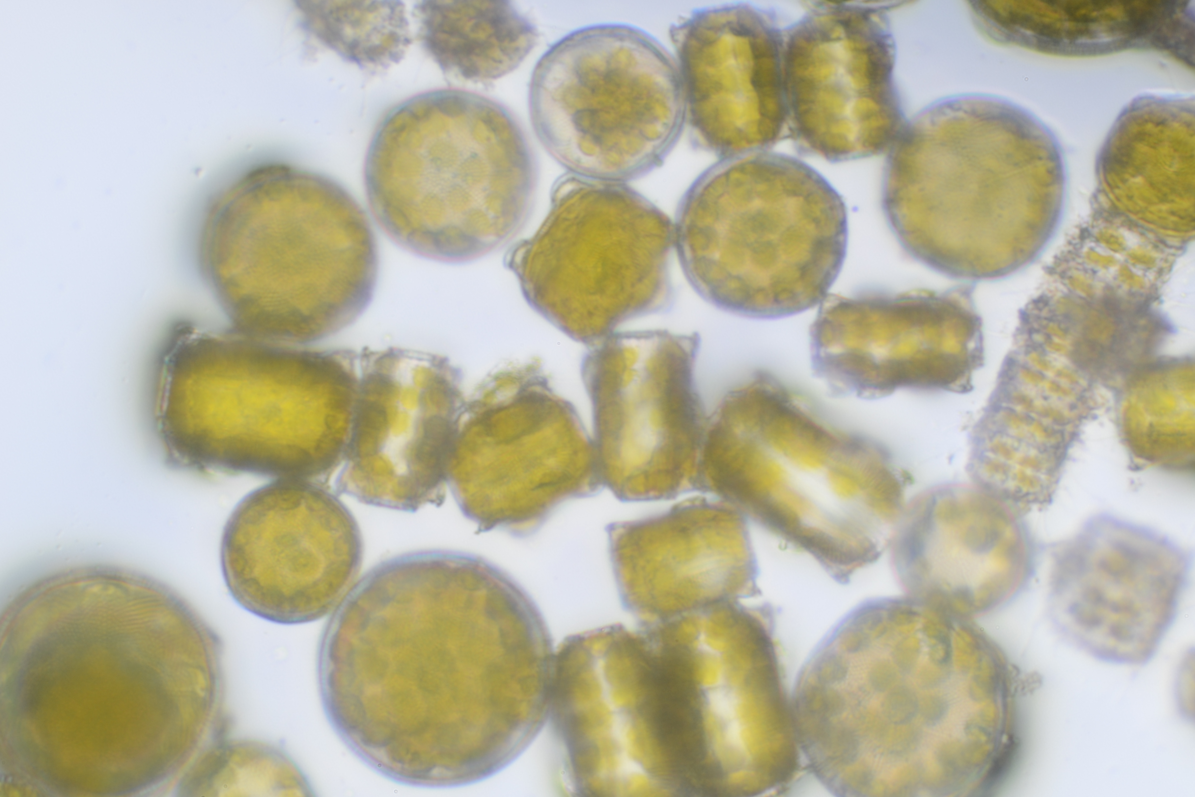 surf diatoms unfer the microscope